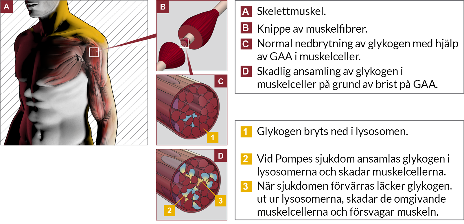 ansamling av glukogen